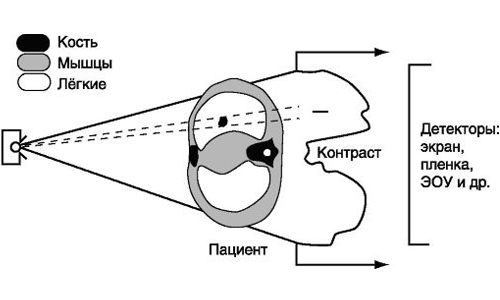 Схема формирования рентгеновского изображения